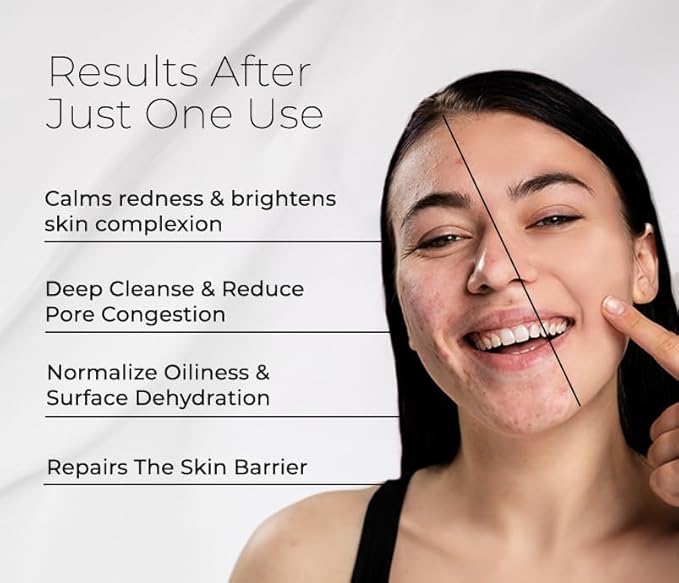 BIONOVA Bioactive Cleanser Oily Skin - Non-Foaming Facial Cleanser Provides a Gentle Deep Clean and Eliminates Excess Oil Face Wash (4.5 fl oz)