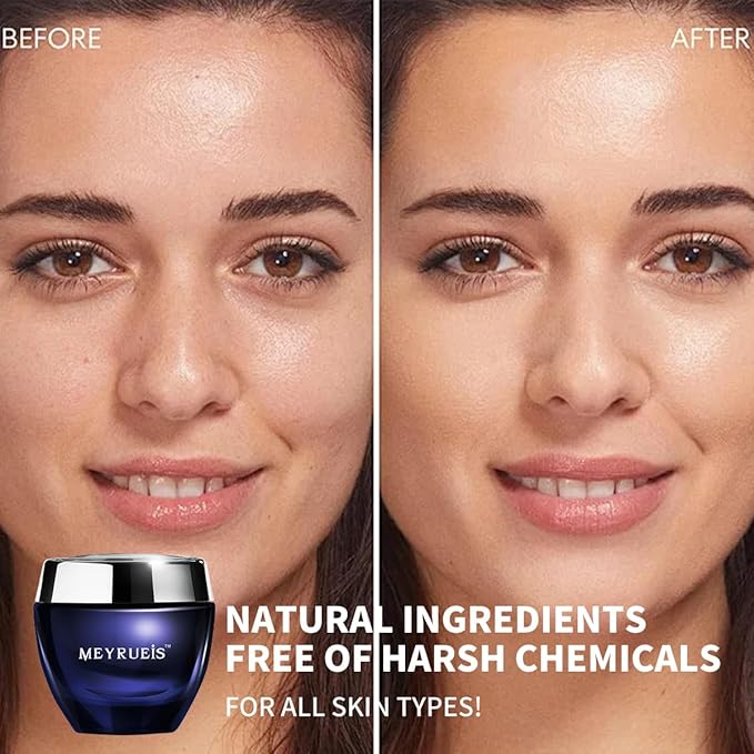 MEYRUEIS Anti-Aging Moisturizer Face Cream, Moisturize Without Oil, Fast-Absorbing, Deeply Nourishing, For All Skin Types, 1.75 Fl Oz