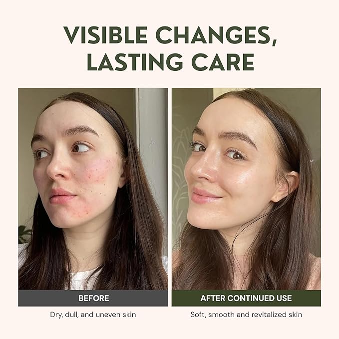 Beef Tallow for Skin Care - 100% Grass Fed Grass Finished - with Organic Jojoba, Prickly Pear, Rosehip, Tamanu Oils, Neroli, Vanilla & Manuka Honey - 3oz