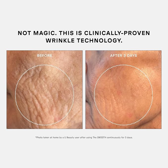 U Beauty The SMOOTH Dynamic Wrinkle Defense Serum - Multi-Peptide Complex, Copper Peptides, Retinol, Centella Exosomes, Vegan Silk Protein for Visible Wrinkle Reduction, Firming & Hydration 5ml