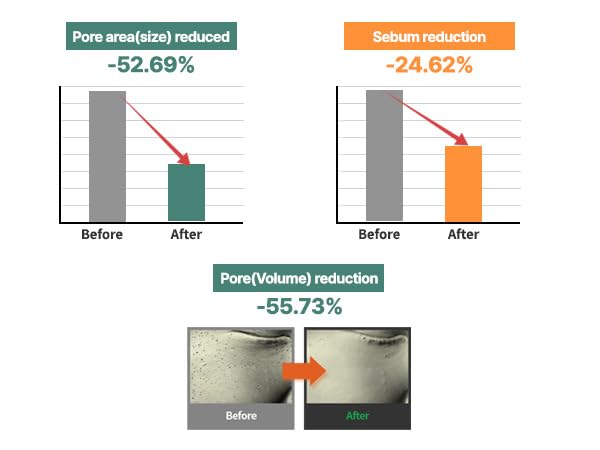 S. Nature AQUA SQUALANE MOISTURIZING CREAM | Face Moisturizer for Dry and Sensitive Skin, Vegetable Squalane 150,00ppm, Long-lasting Hydration, Pore Care Cream, Korean Skin Care (2.7 Fl Oz, 80ml)