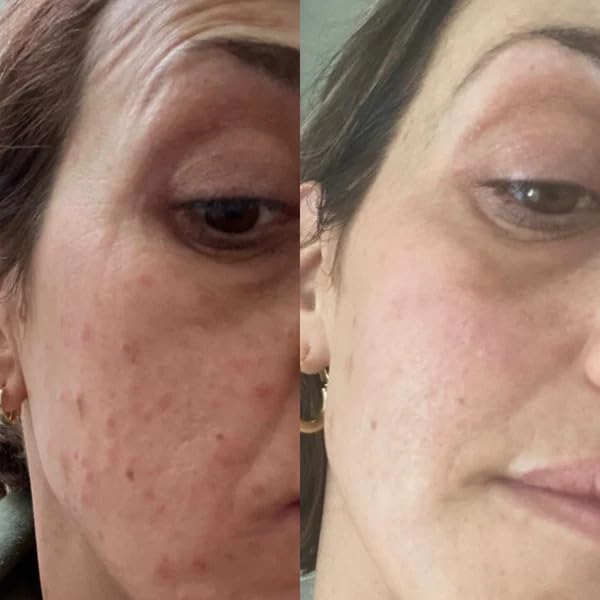 Gin Amber Beauty - Vitamin C (10%) + Squalane Repair Cream - Face Moisturizer - Skin Cream - Dark Spot Corrector - Primer (1 fl oz - 30ml)