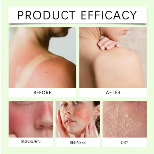 Aloe Vera Gel for Face and Body, Soothing & Moisturizing Gel with Carbomer, Repairs Dry Skin, Brightens Skin Tone, Daily Use for All Skin Types（130ml