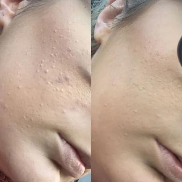 Gin Amber Beauty - Natural AHA/BHA Exfoliating Cleanser | Brightening, Even Texture | For All Skin Types (4 fl oz - 120 ml)