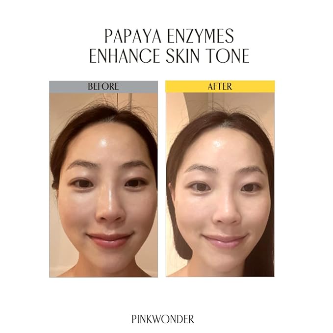 PINKWONDER Neroli Oil Balm Cleanser 4.23oz(120g), Cleansing Oil Balm Face Wash, Removes Makeup and Impurities, Niacinamide and Neroli for Glowing Skin, Korean Skincare