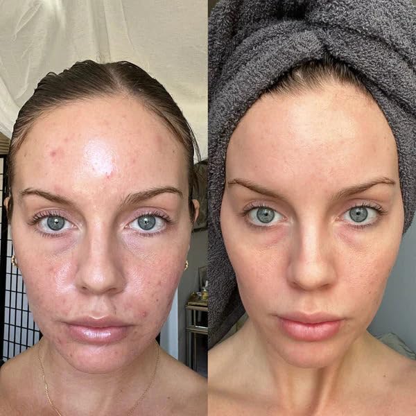 Gin Amber Beauty - Natural AHA/BHA Exfoliating Cleanser | Brightening, Even Texture | For All Skin Types (4 fl oz - 120 ml)