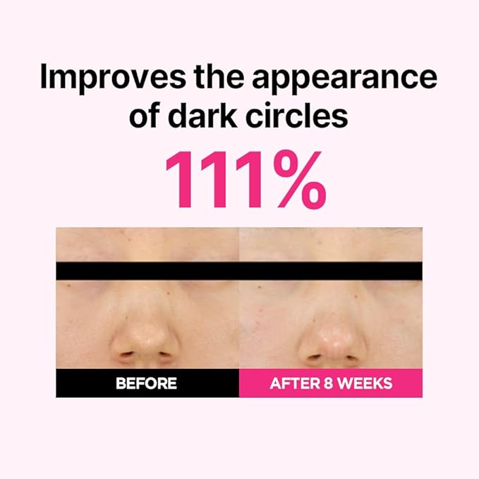 ISOI Blemish Care Under Eye Patch for Dark Circles, Puffiness and Wrinkles, Hydrating Gel Eye Masks with Hyaluronic Acid & Bulgarian Rose Oil, Korean Skin Care (90 pcs, 3.17 oz)