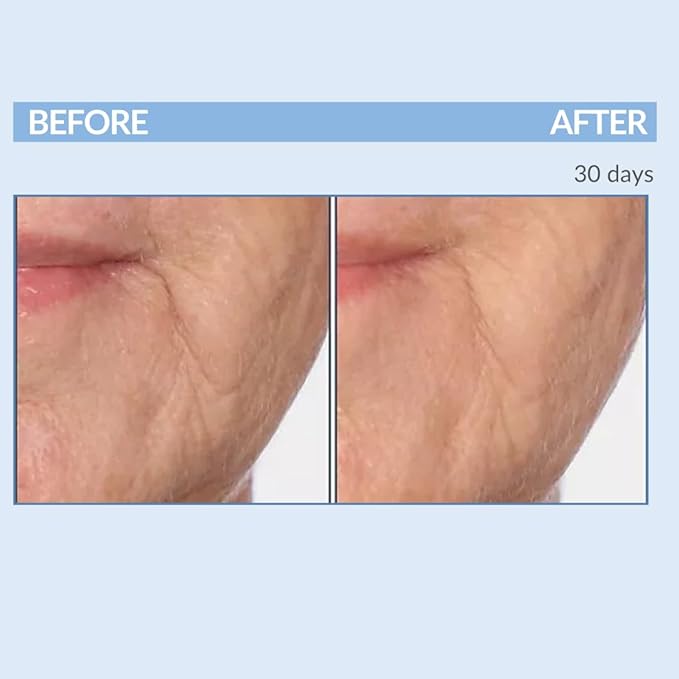 Serious Skincare Retinol Vitamin A Cream XR Premium Moisturizer for Face & Neck 2 fl oz, Anti-Aging - Day & Night - Reduce Fine Lines & Wrinkles - For Radiant Skin Set of 2