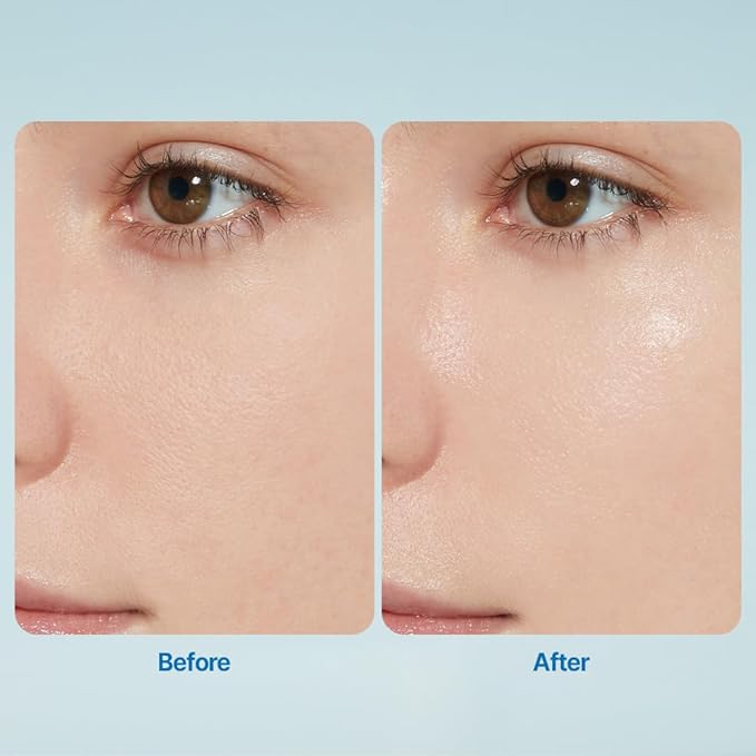 ETUDE SoonJung 2x Barrier Intense Cream Set | 2x Barrier Cream 2.02fl.oz + Ph 5.5 Relief Toner 0.85 Fl.oz. + Foam Cleanser 0.68 Fl.oz. | Oil & Water Balance, Korean Skin Care