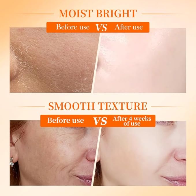 5x Vitamin C Skincare Set,Revitalizing Toner, Nourishing Essence, Face Moisturizer, Deep Cleansing & Hydration Balance, Refines Pores & Enhances Luminosity, Unique Gift for Women