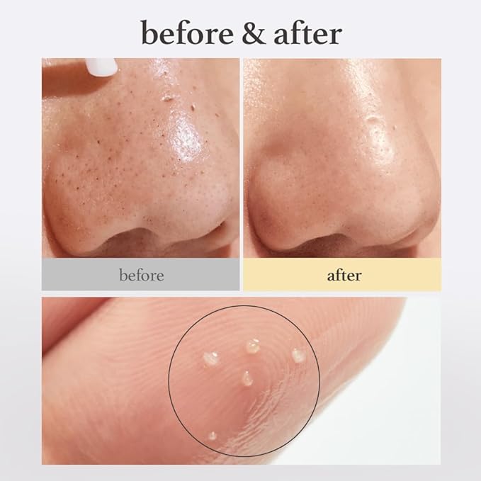 NOONI Double Cleansing Duo and Toner Pads - Mom’s K-Beauty Cleansing Trio