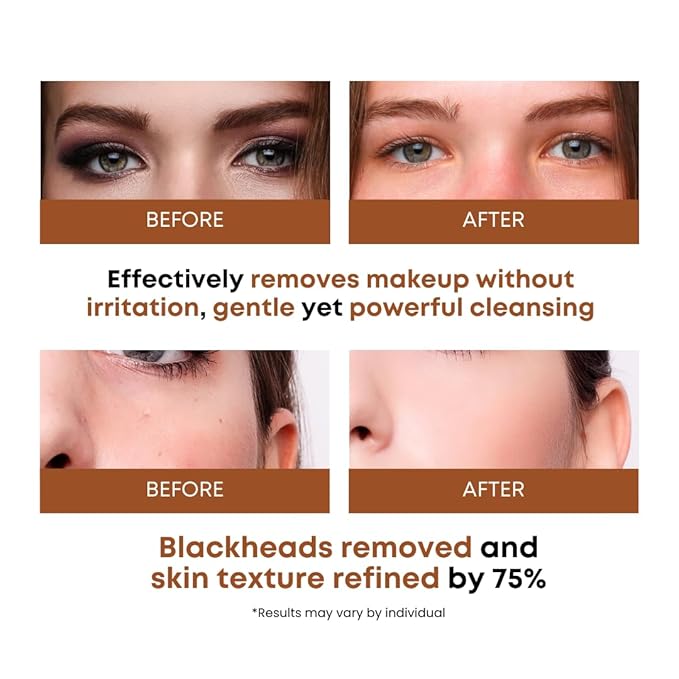 Rice Water Cleansing Pads – Makeup Remover Wipes & Korean Toner Pads with Centella Asiatica, Exfoliating for Blackhead Removal & Pore Minimizer, 50 Pad