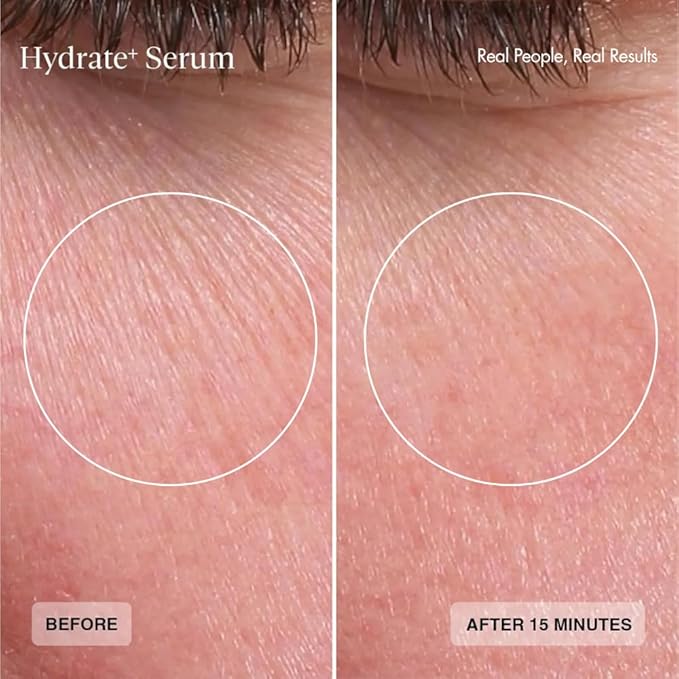 Senté Hydrate+ Serum | Hyaluronic Acid with HSA for Glass Skin | Deep Hydration, Barrier Support & Post-Procedure Care | Fast-Absorbing | Calms & Soothes | Paraben, Cruelty, Fragrance Free | 1.0 oz