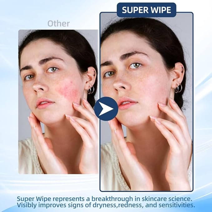 SUPER WIPE Towels - The original- Thickened, Gentle, Ultra Soft Face/Skin Towelettes-Super Absorbant, Lint-Free- Single Use - Viscose Material- 50 counts X (1)