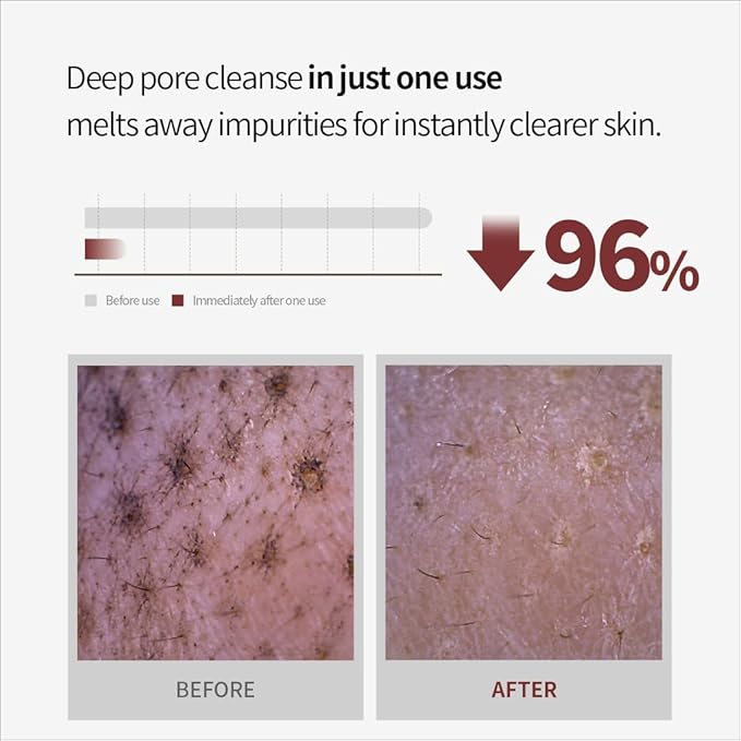 NACIFIC Rice Pepta Collagen Skincare Set – Cleansing Balm, Gel Mask & Peel-Off Wrapping Mask | Korean Glass Skin Routine Kit for Hydration, Pore Care, Brightening & Sensitive Skin