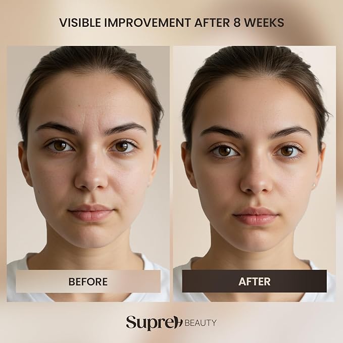 Bee Venom Wrinkle Cream: Wrinkle Cream for Women with Bee Venom Hyaluronic acid Niacinamide and Peptides - for fine lines and face firming 50ML