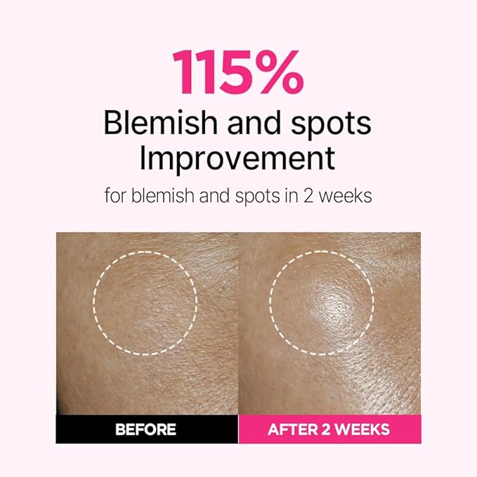 ISOI Blemish Care Up Facial Serum Triple Set, Korean Skin Care Set for Glass Skin Radiance, 2 Full Size & 1 Refill, Eye & Wrinkle Patch Tester, Daily Hydration Skincare Gift for Women (2.13 fl. oz)