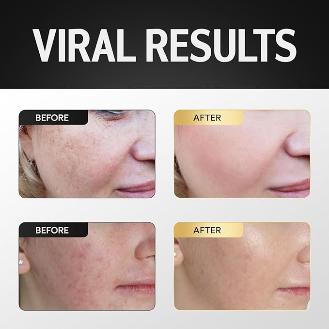 Whipped Beef Tallow and Honey Balm, 100% Grass Fed Beef Tallow Balm, Grass Finished Organic Beef Tallow for Skin, Face Wrinkles, Acne, No Fragrances, Made In USA Products Only, TikTok Trend Items