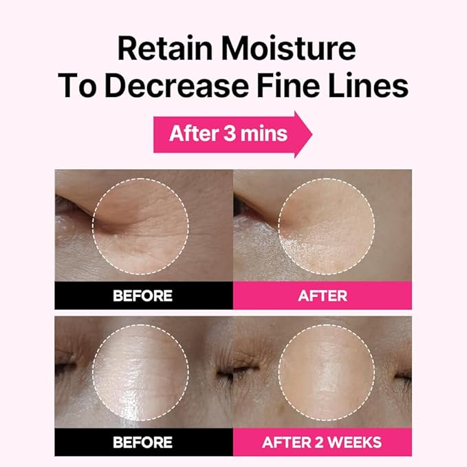 ISOI Blemish Care Up Facial Serum Triple Set, Korean Skin Care Set for Glass Skin Radiance, 2 Full Size & 1 Refill, Eye & Wrinkle Patch Tester, Daily Hydration Skincare Gift for Women (2.13 fl. oz)