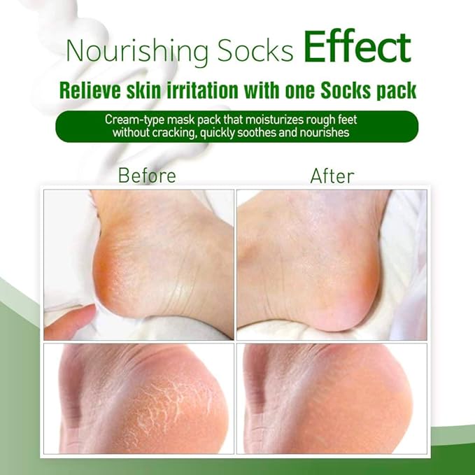 Epielle Nourishing Foot Masks 6 Pairs, Deep Moisturizing Socks for Dry Feet & Cracked Heels, Repair and Nourish with Hemp & Rosemary Extract, Foot Spa & Self Care Gifts for Women, Korean Skin Care
