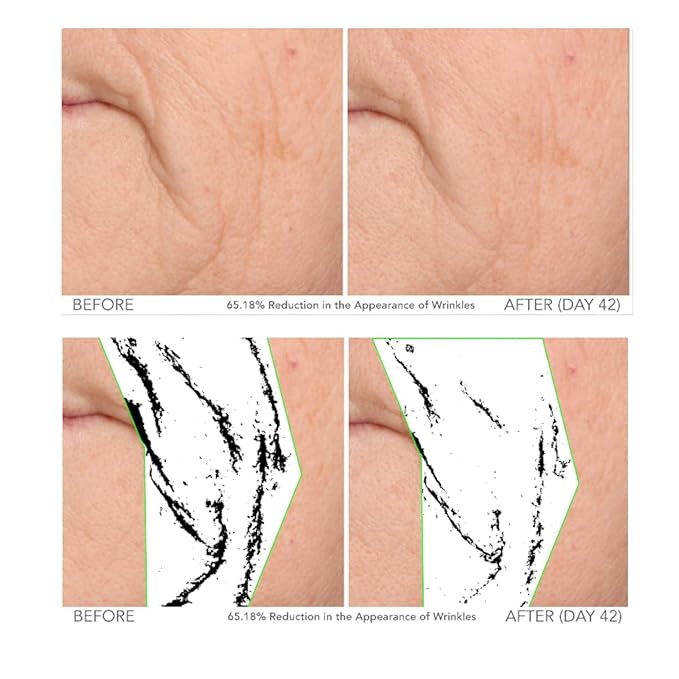 Serious Skincare - Beyond Intensive Vitamin C Serum for Face - 60 Day Facial Treatment for Healthy Glowing Skin and Brightening - Smoothes Lines, Pores and Fades Dark Spots - 2 Piece Anti-Aging Set