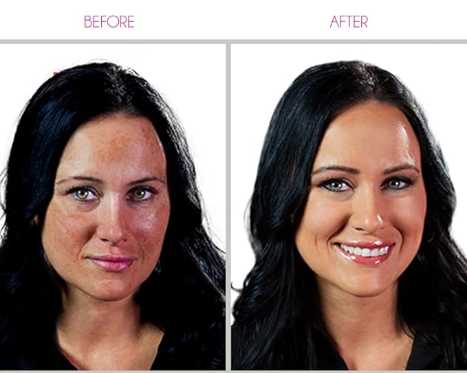 Dinair Airbrush Makeup Master Foundation Collection - Camouflage Neutralizer perfect to cover Scars, Acne, Tattoos, Under Eye Circles, Sun Spots, Vitiligo.