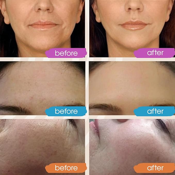 GLEOW Vitamin C Face Serum, Hydrating Vitamin C Serum for Face with Hyaluronic Acid, Suitable For All Skin Types, Targets the Appearance of Dull Spots 2oz