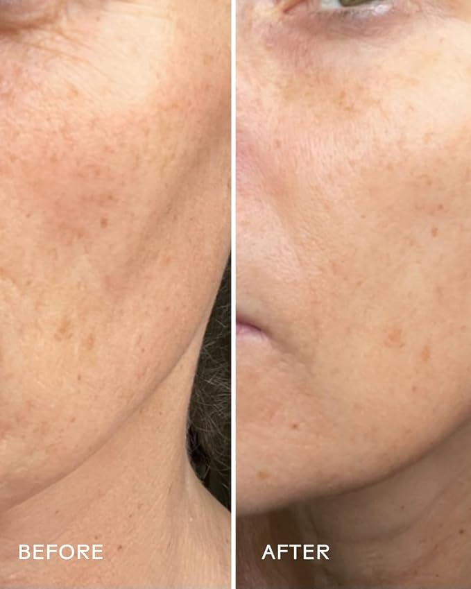 Three Ships - Boost 49% Rosehip Oil Serum | Moisturize, Firm, Plump Skin | Cruelty-Free, Vegan, Paraben-Free, Sensitive Skin Safe (1 fl oz | 30 mL)