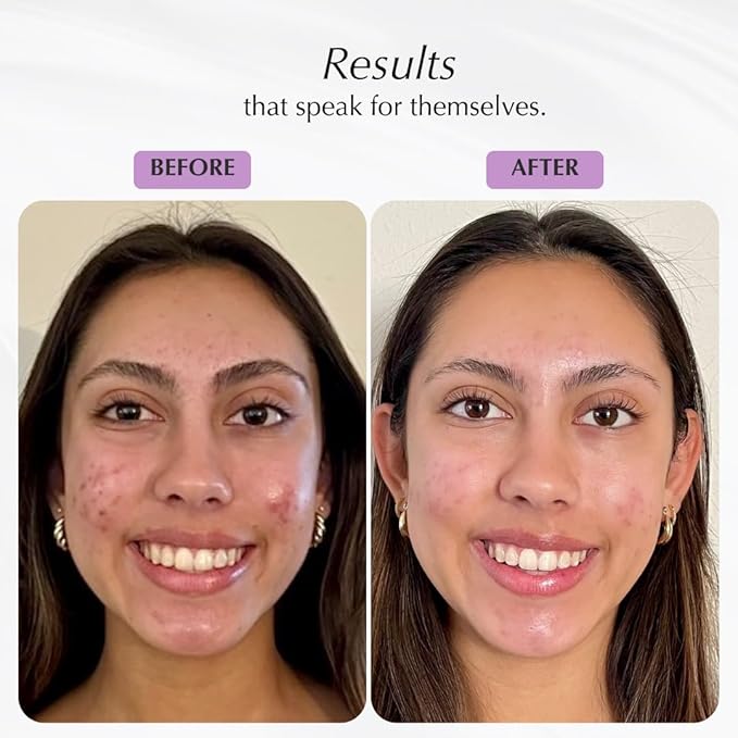 SHIMMER CHEF Papaya Purée Face & Neck Plaster | Botanical Skin-to-Mind Mask | Revitalizes & Fortifies Complexion with Vitamins A, C & E | Exotic Bouquet Uplifts Mood | 2.5 oz