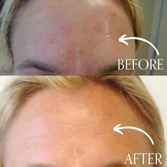 Radical Skincare Age Defying Exfoliating Pads Removes Dead Skin, Evens and Brightens Skin Tone for Radiant Glow | For All Skin Types Including Sensitive Skin | Paraben & Cruelty Free (15 Pads, 2 Pack)