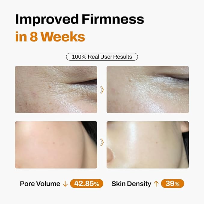 JEU'DEMEURE DermiShuttle Lifting Kit - Anti Aging Serum, Face Serum for Firming, Anti Wrinkle, Skin Elasticity, Hydrating with Collagen, Peptides, Korean Skincare (8 Weeks)