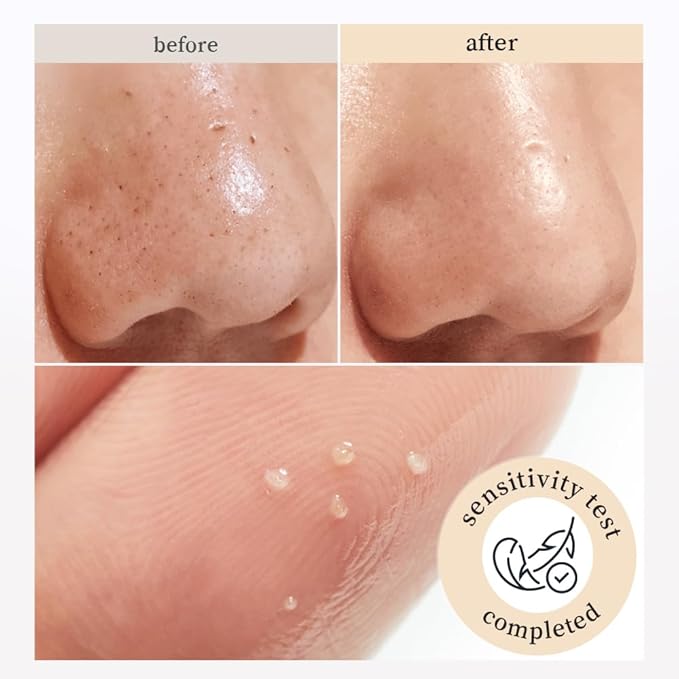 NOONI Top Sellings & Hot Deal Set – Rice Cleansing Oil & Applepeony & Applemint Lip Oil