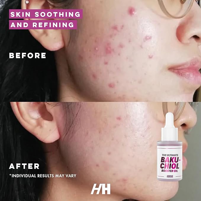 Handmade Heroes 2% Bakuchiol Oil Lifting and Firming Oil for Guasha Neck, and Décolleté, All Natural Retinol Alternative For Radiant and Line Smoothing 0.75oz