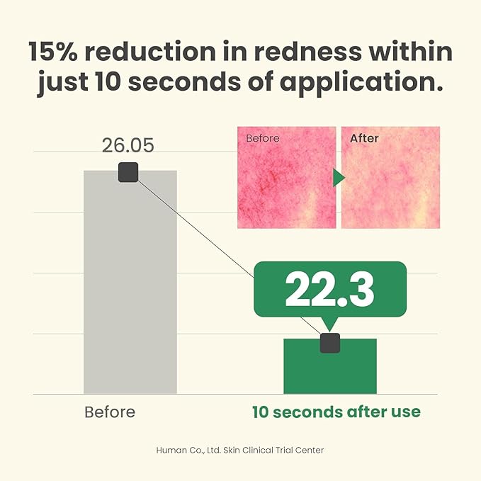 AXIS-Y Dark Spot Correcting Glow Toner - Brightening & Hydrating with 5% Niacinamide, Glutathione & Hyaluronic Acid - Vegan Korean Skin Care Exfoliator Face Toner for All Skin Types - 4.23 fl. oz.