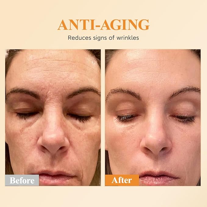 HKH Vitamin C Serum For Face, Anti-Aging Vit C with Vitamin E Serum 48 Capsules, Evens Skin Tone & Reduces Wrinkles, Travel Size Skincare Capsules for Smoothing, Hydrating & Firming Skin