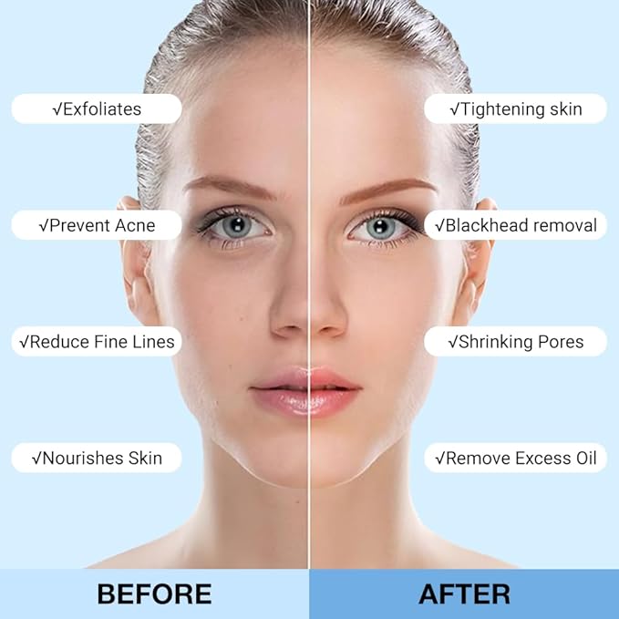 Clay Mask For Face Skincare, Blackhead Remover Face Mask with Blueberry Extract, Deep Pore Cleansing, Moisturizing, Skincare Facial Mask for Refining Pores and Controlling Oil, 40g/1.35oz