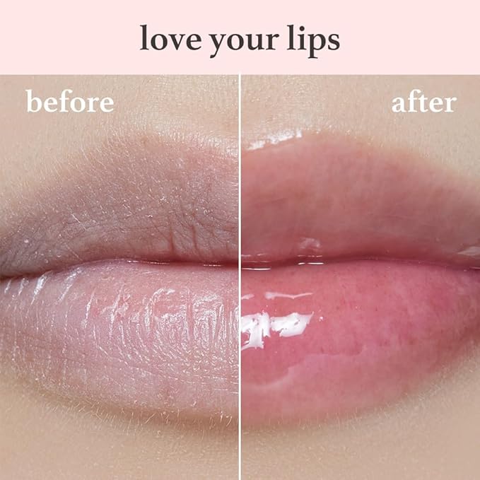 NOONI Korean Hydrating Lip Oil Gift Set + Applepeony Bundle