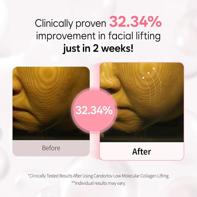 Overnight Collagen Lifting Gel Mask 5 pcs, Korean Face Lifting Deep Hydrogel Mask for Glass Skin, Anti-Aging with PDRN, Hyaluronic Acid for Elasticity, Firmness