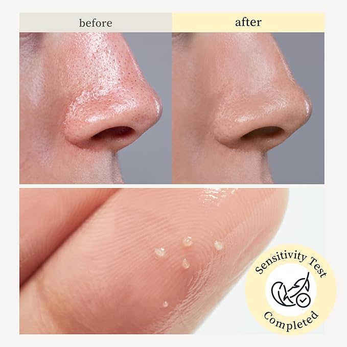 NOONI Top Pick Set – LHA Cleansing Oil & Applepeony LO & Appletea Lip Oil