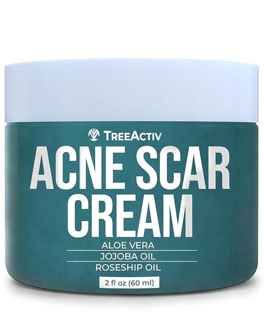 TreeActiv Acne Scar Treatment, 2 fl oz, Scar Cream for Face and Dark Spot Remover, Lotion for Stretch Marks and Body, Acne Scar Removal for All Skin Types, 500+ Uses
