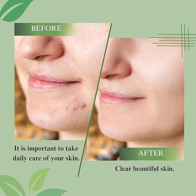 ELEVENSKIN Refresh Antioxidant Facial Cleanser – Gentle Gel Face Wash & Hydrating Cleanser – Daily Hydrating Face Wash & Makeup Cleanser for Women & Men – Seaweed Enriched, Suitable for All Skin Types