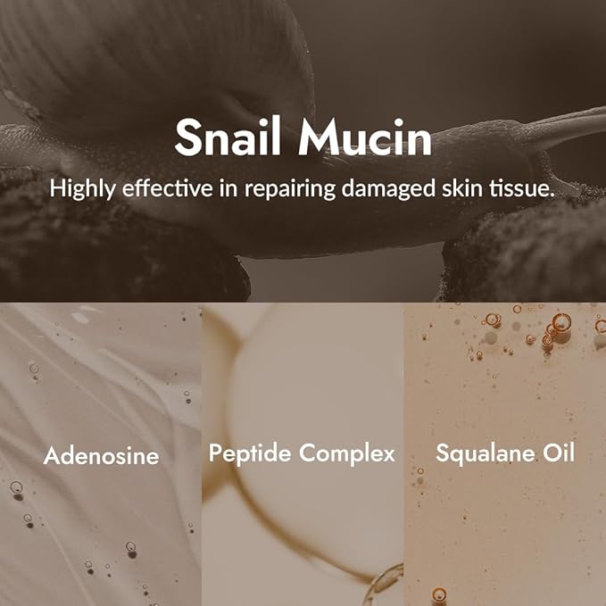 MIZON Snail Line Snail Repair Eye Cream, natural treatment, wrinkle treatment, fine line, hydrating, healthy skin, Korean skincare (0.84 oz)