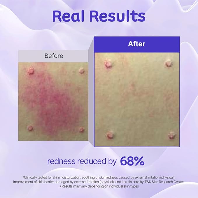 kift Multi-Solution Miracle Cream, All-in-One Moisturizer & Overnight Mask for Deep Hydration, Soothing Sensitive Skin, Pudding-Like Texture, Fragrance-Free, 1.69 fl oz