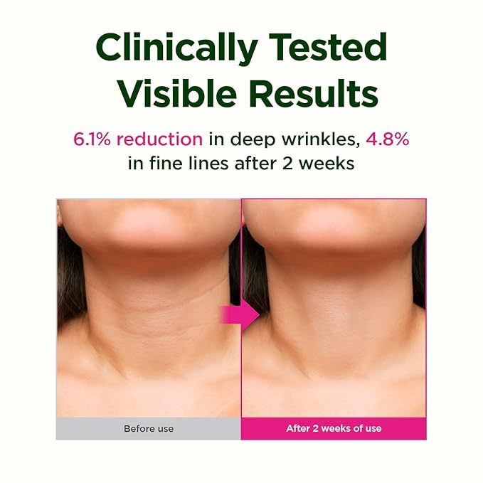 CKD Retino Collagen Gua Sha Neck Cream - Firming Cream for Neck and Jawline Tightening, Lifting, and Wrinkle Reduction with Stainless Steel Roller. Korean Skin Care,1.69 fl oz.