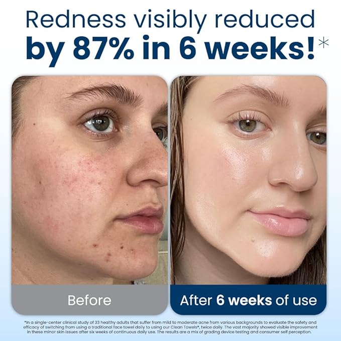 Clean Skin Club Clean Towels XL™, 100% USDA Biobased Face Towel, Disposable Face Towelette, Eczema Association Accepted, Makeup Remover Dry Wipes, Ultra Soft, 300 Ct, 6 Pack