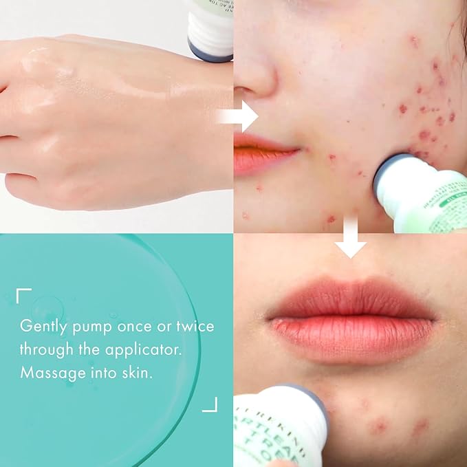 Heartleaf Tea Tree Tok, Acne Treatment, Soothing Toner Serum, Centella Asiatica, Korean Facial Skincare for Pore Control, Calming, Nourishing. 50ml, 1.69 fl. oz.