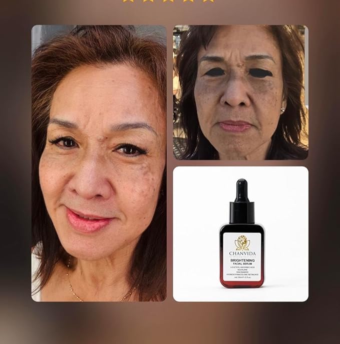 Brightening Facial Serum has Vitamin C, Niacinamide, Retinoate, Vitamine E, and Natural Ingredients help Reduce Dark Spots & Hyperpimentation, Smooth & Evens Skin Tone, Reduces Fine Lines.