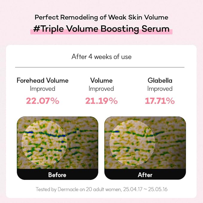 Niacinamide Serum with Botanical Extracts | Dark Spot Corrector, Glow Enhancing, Even Tone & Hydrating Face Serum for Radiant Skin | Korean Beauty (30ml, Firming)