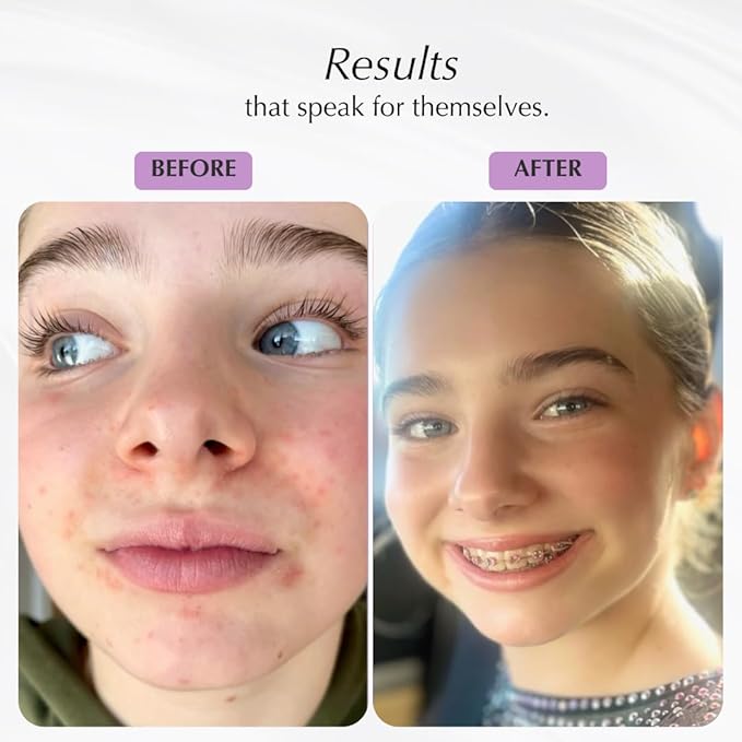 SHIMMER CHEF Honey Lime Polenta Face & Neck Plaster | Mindful Beauty Mask | Refines & Nourishes for Resilient, Radiant Skin | 5.5 oz