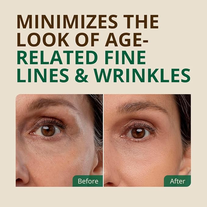 Vitamin E Oil - 100% All Natural & USDA Organic (LARGE 4oz Bottle) Repair Dry, Damaged Skin from Surgery & Acne, Age Spots & Wrinkles. For Radiant, Hydrated & Youthful Skin. Face & Body Moisturizer